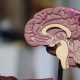 AI For Advanced Dynamic Brain Imaging