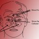 Sinus Headache – What is it?