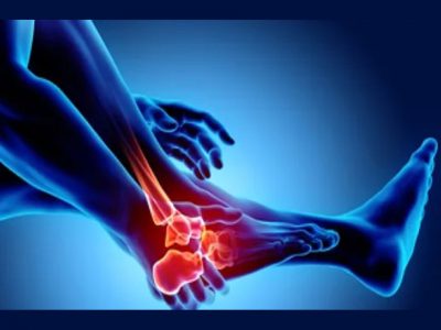 Arthritis – Who are at risk?