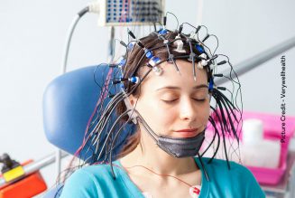 EEG – Electroencephalogram Basics