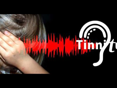 Analgesics And Risk Of Tinnitus